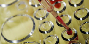 Bipolar-Biomarker